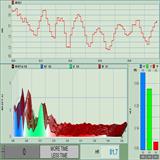 ecg-Link-HR-to-FFT-