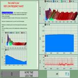 ecg-lower-VLF-